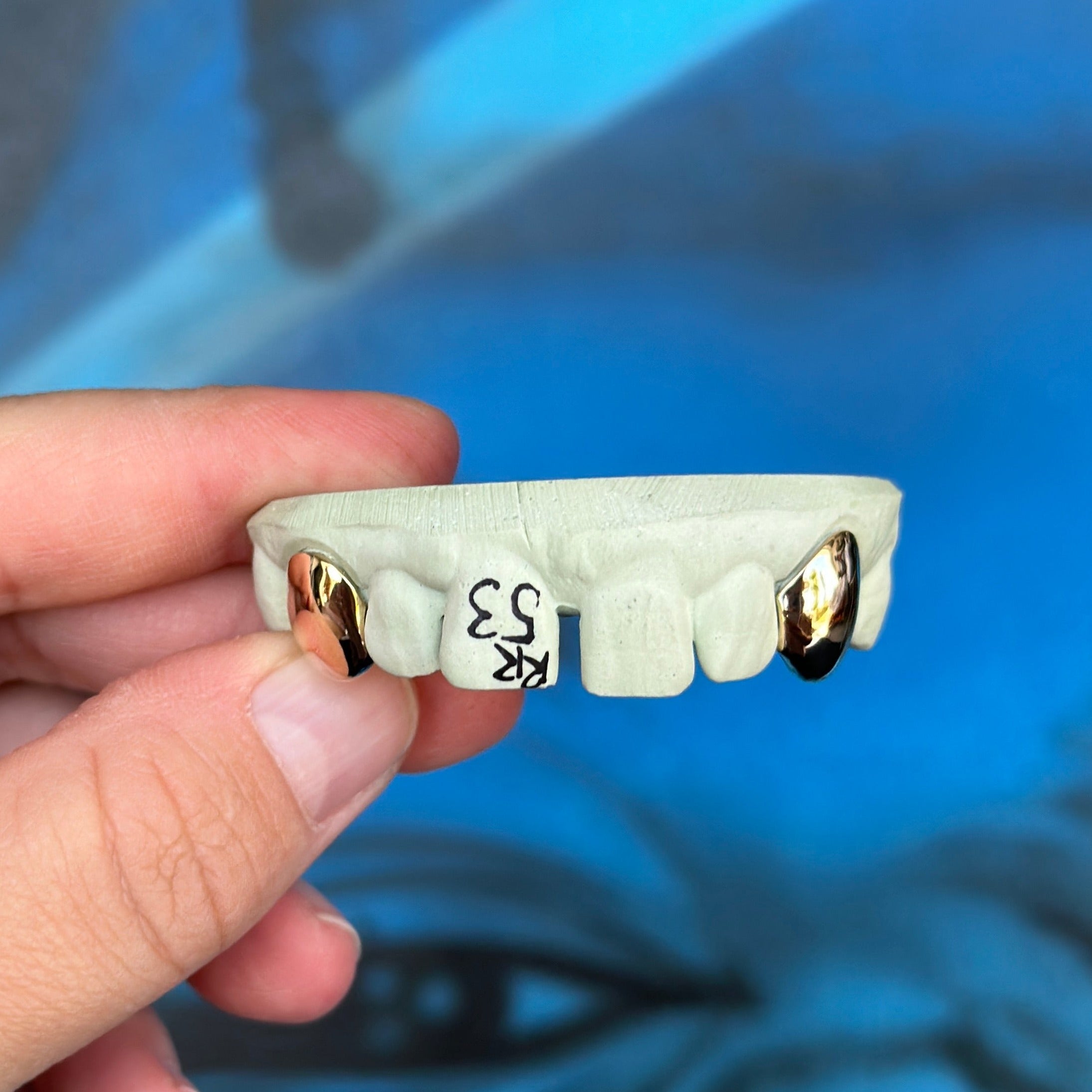 Single Gold Caps - Grillz Australia