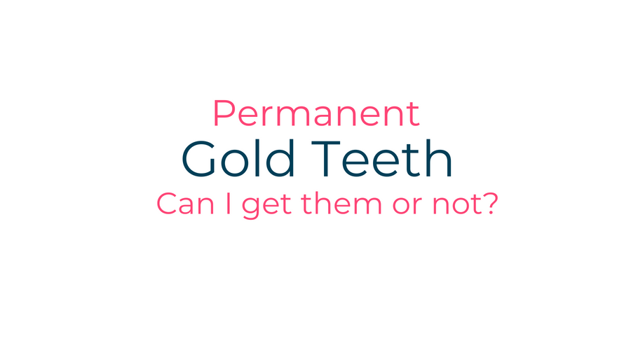 Can I Get Permanent Gold Grillz?