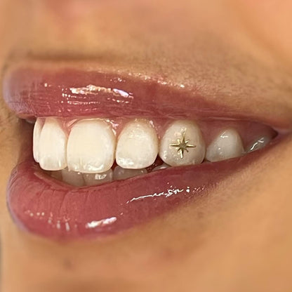 Sparkle Tooth Charm