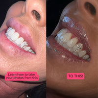 Level Up Your Tooth Gem Content Ebook