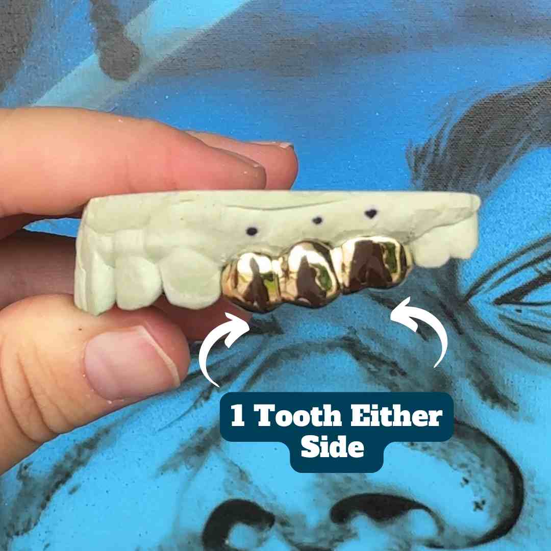 3 Piece Missing Tooth Cover Up Grillz - Grillz Australia