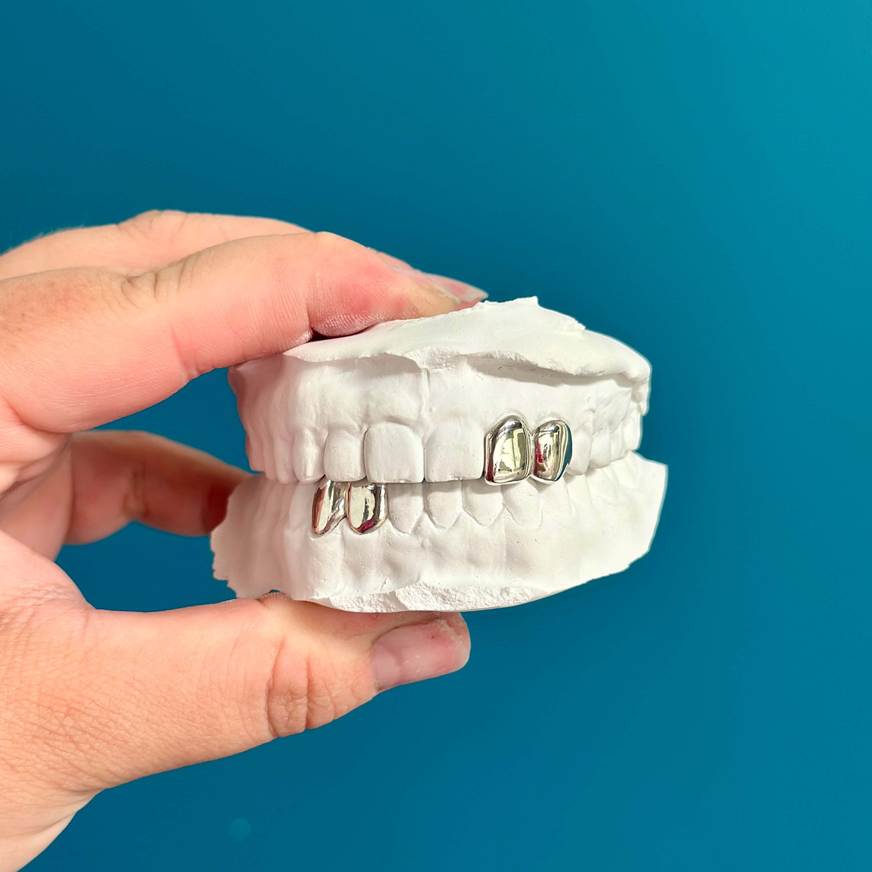 4 Teeth Solid Piece Grillz Set - Grillz Australia