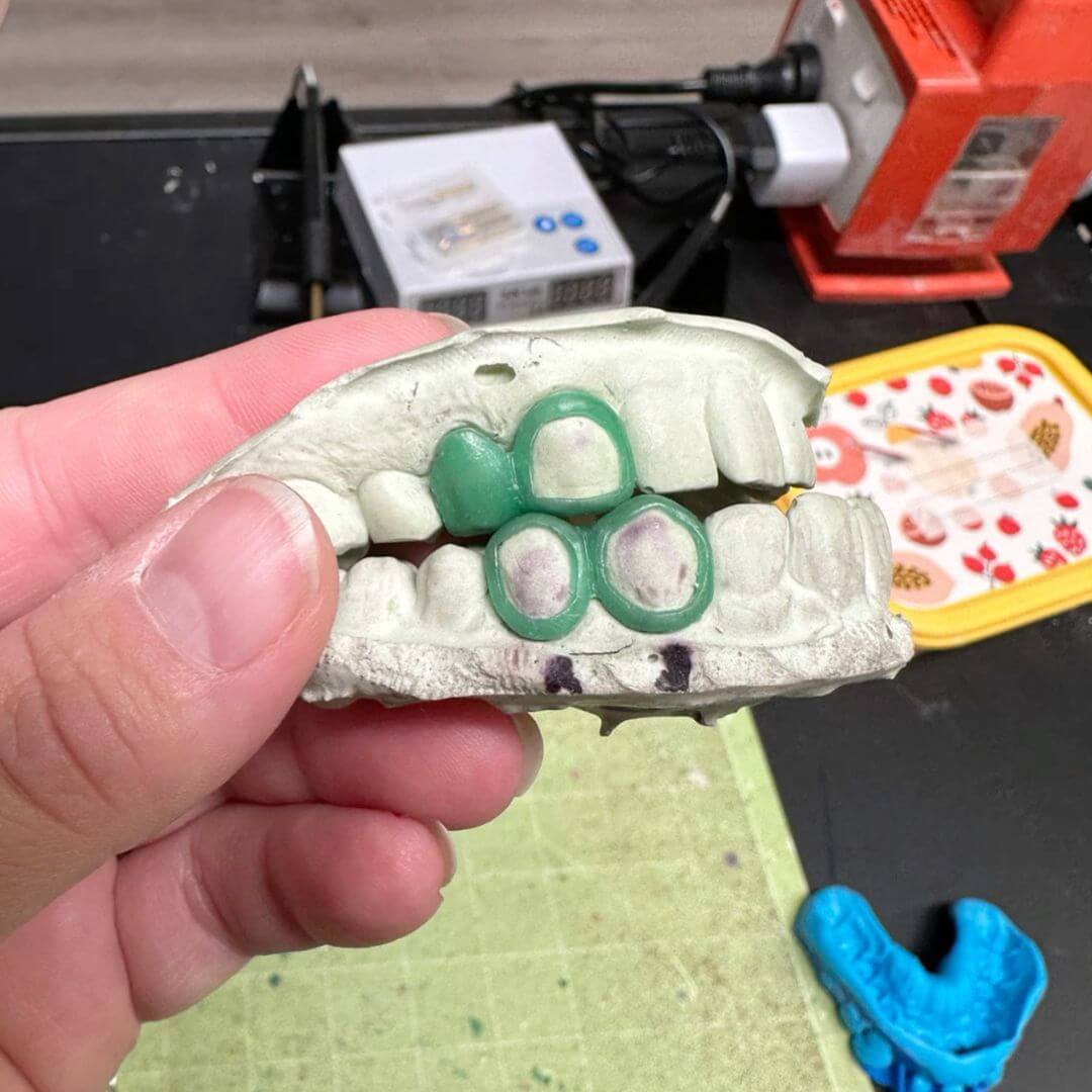 Grillz Wax Up Mini Training