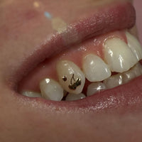 Cherry Hearts Tooth Charm