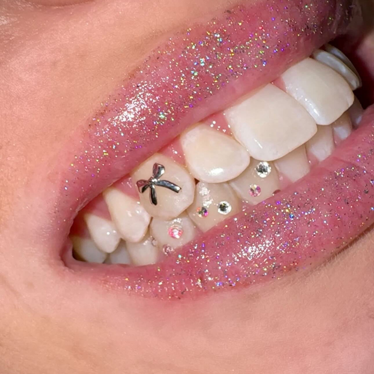 Dainty Bow Tooth Charm