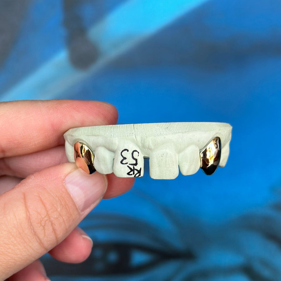 Single Gold Caps - Grillz Australia
