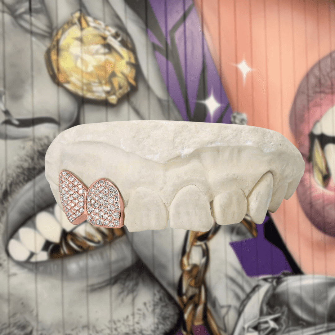 Price of diamond grillz on sale