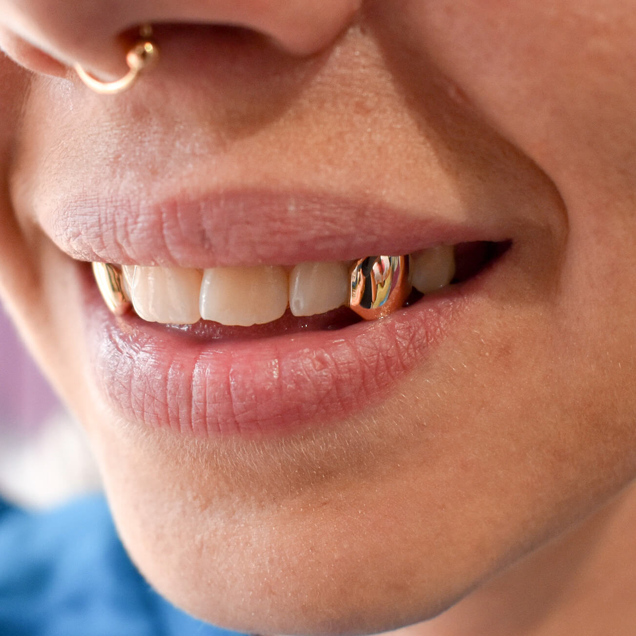 Canines with Back Bar Grillz Grillz Australia Mouth House