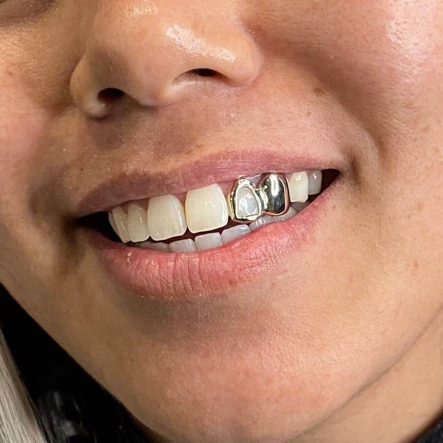 Solid Gold Open Face Grillz Grillz Australia Mouth House