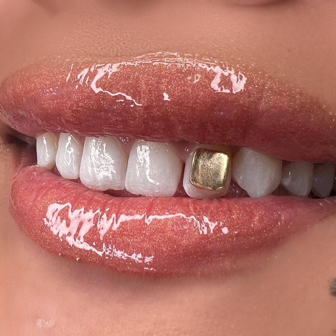 18k Gold & Diamond Tooth Gems Temecula