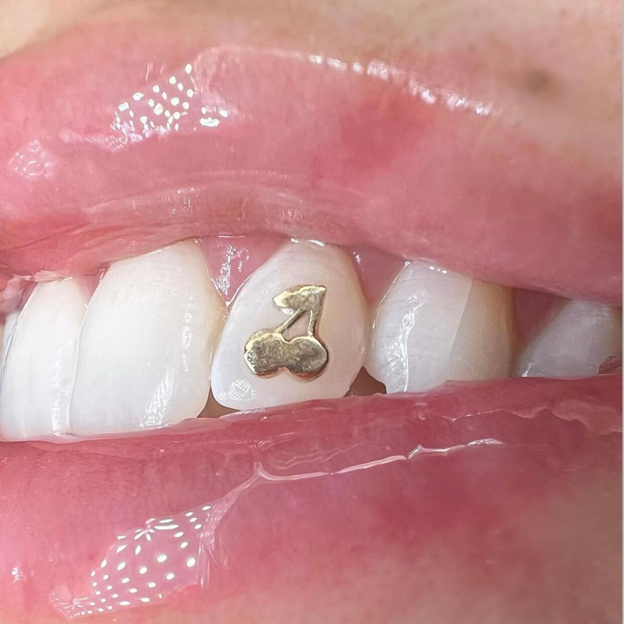 Cherry Tooth Charm
