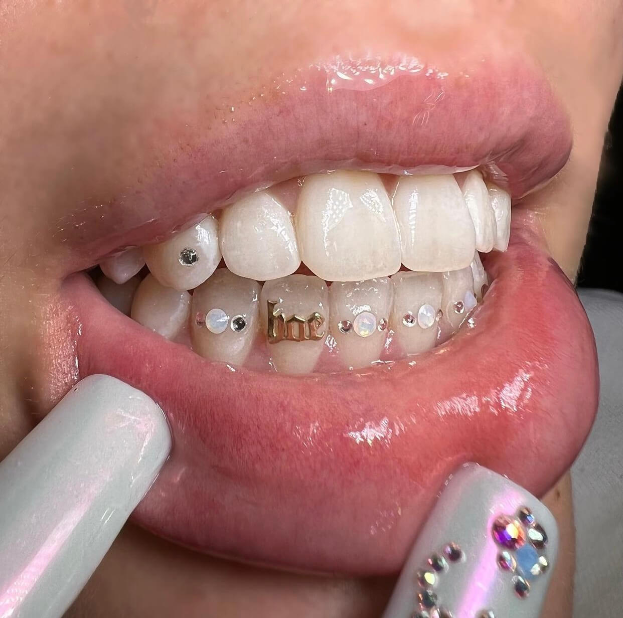 Cherry Tooth Charm