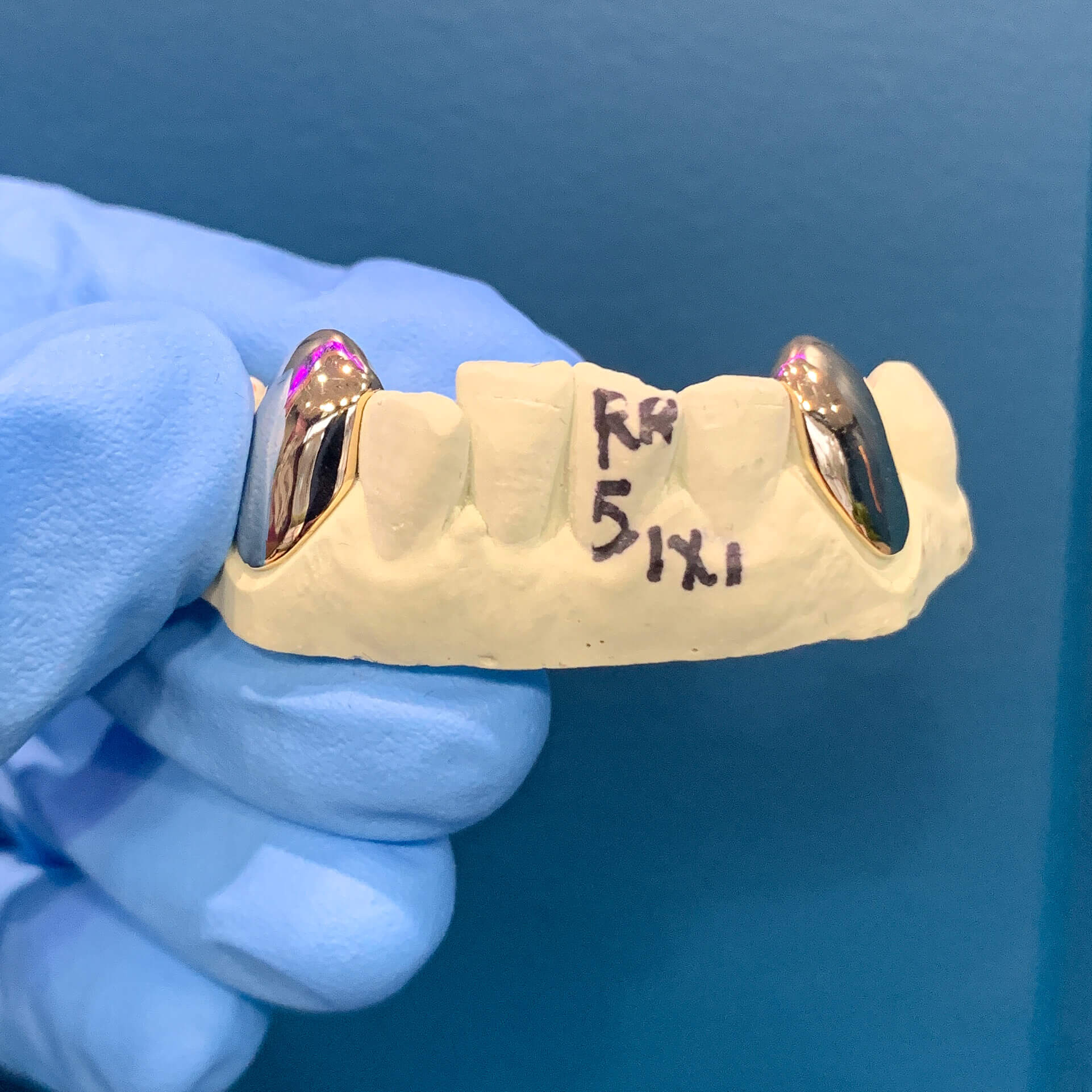 gold grillz, gold grillz aus, gold grillz australia, grillz australia, grills, gold caps, gold teeth, 10k caps, 10k gold grillz, 14k gold grillz, 18k gold grillz, how to order grillz, mouth house, mouth house grillz, custom gold grills, custom gold teeth, hip hop grillz, fang grillz, silver grillz, vampire grillz, open face grillz, solid grillz, diamond grillz, iced out teeth, rapper grillz, white gold grillz, rose gold grillz, bottom grillz, top grillz, VVS diamonds, VVS grillz, permanent gold crowns