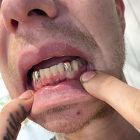 gold grillz, gold grillz aus, gold grillz australia, grillz australia, grills, gold caps, gold teeth, 10k caps, 10k gold grillz, 14k gold grillz, 18k gold grillz, how to order grillz, mouth house, mouth house grillz, custom gold grills, custom gold teeth, hip hop grillz, fang grillz, silver grillz, vampire grillz, open face grillz, solid grillz, diamond grillz, iced out teeth, rapper grillz, white gold grillz, rose gold grillz, bottom grillz, top grillz, VVS diamonds, VVS grillz, permanent gold crowns