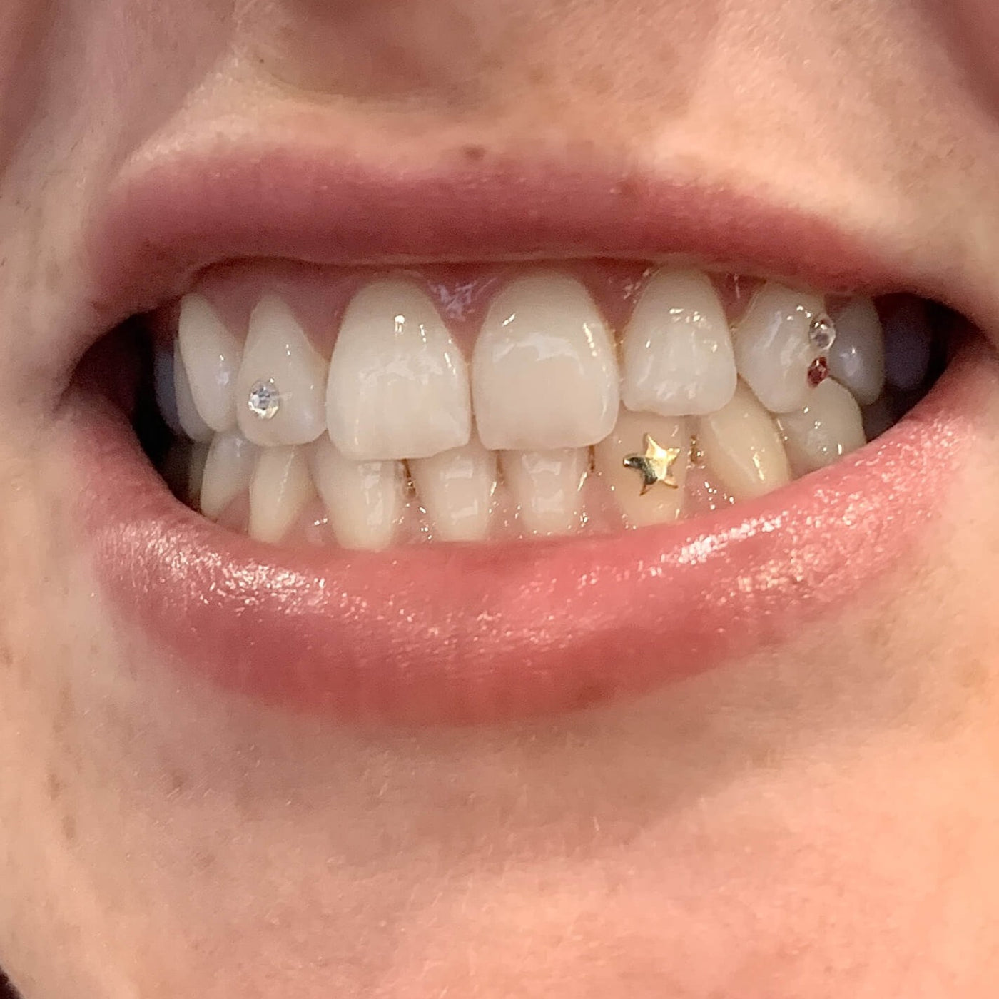 Star Tooth Charm · Mouth House - Main Image