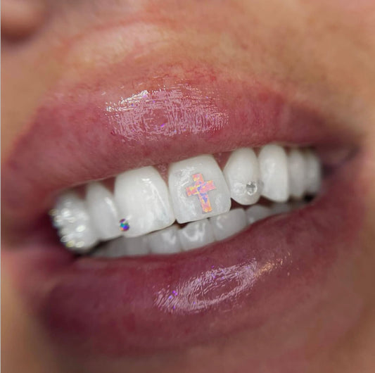 Bat Opal Bead Gemstone Tooth Gems Glue Opal Cute Tooth Gem Charm Stone -  China Smile Opal Tooth Gems and Dental Safe Gems price